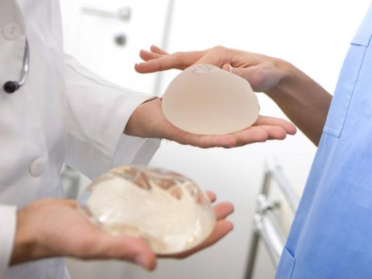 implantes