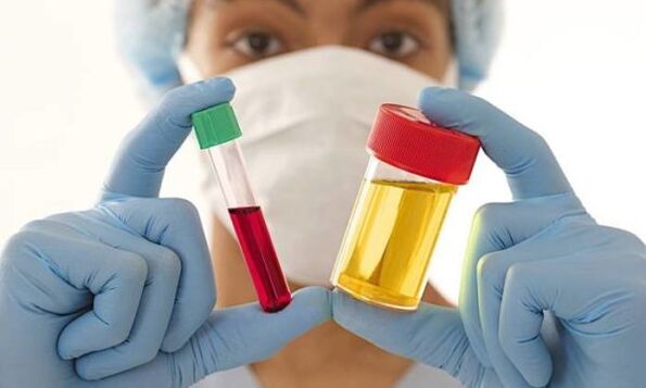 análises de sangue e orina antes da cirurxía de aumento mamario