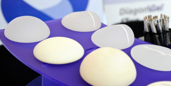 tipos de implantes para a ampliación de mama